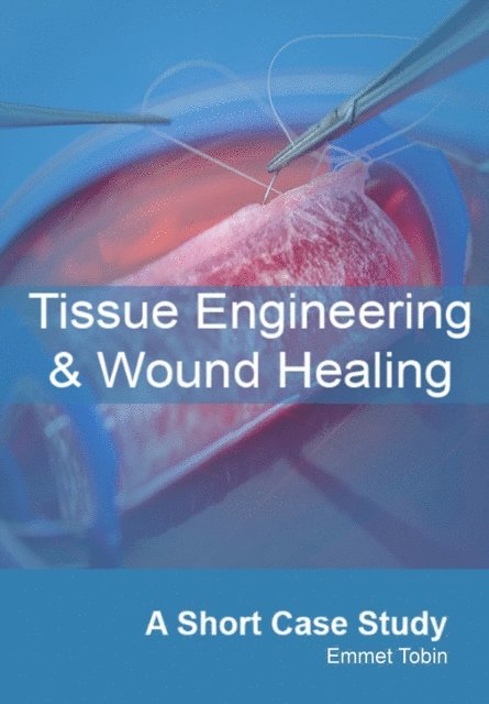 Emmet Tobin - Tissue Engineering and Wound Healing: A Short Case Study, E-bok. Tillgänglighet: Lägg i varukorg