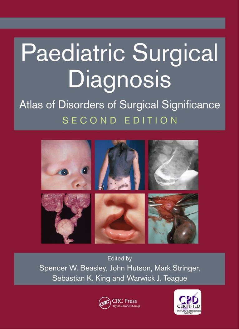 Spencer Beasley, John Hutson, Mark D Stringer, Sebastian King, Warwick Teague - Paediatric Surgical Diagnosis, E-bok