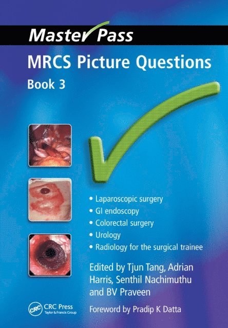 Bandipalyam Vamana Rao Praveen, Tjun Tang - MRCS Picture Questions, E-bok. Tillgänglighet: Lägg i varukorg