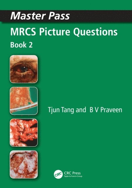 BV Praveen, Tjun Tang - MRCS Picture Questions, E-bok. Tillgänglighet: Lägg i varukorg