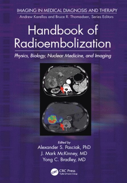 MD. McKinney, MD. Bradley, PhD. Pasciak - Handbook of Radioembolization, E-bok