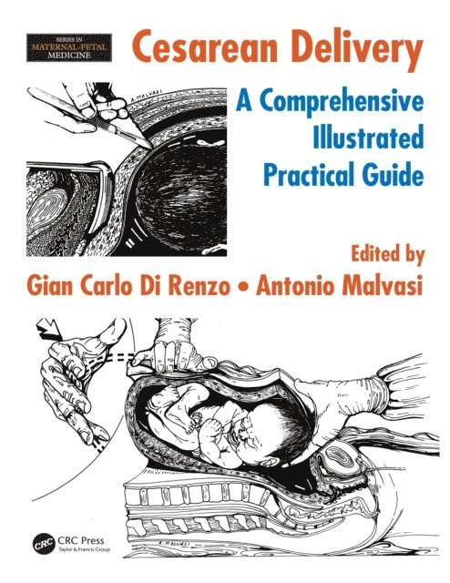 Antonio Malvasi, Gian Carlo Di Renzo - Cesarean Delivery, E-bok