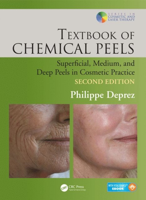 Philippe Deprez - Textbook of Chemical Peels, E-bok