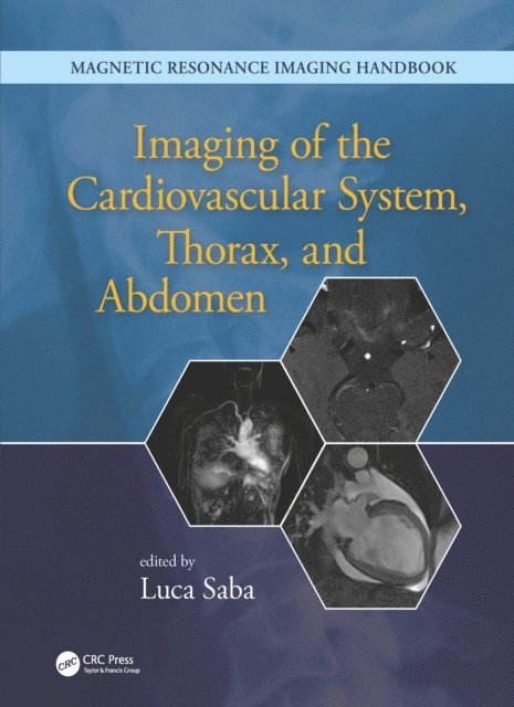Luca Saba - Imaging of the Cardiovascular System, Thorax, and Abdomen, E-bok