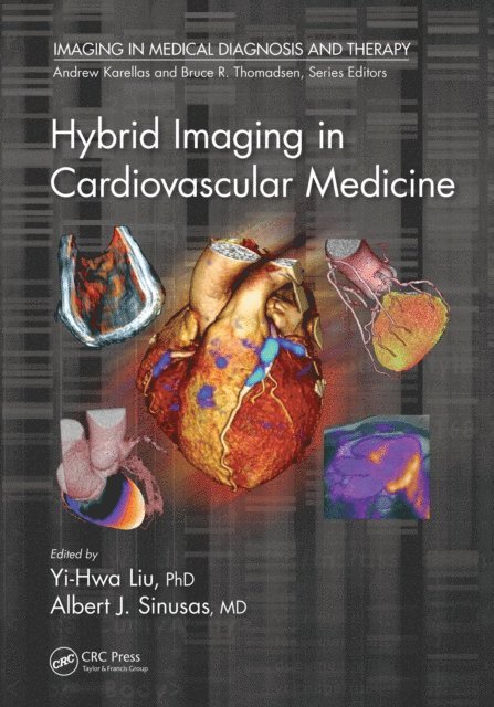 Albert J. Sinusas, Yi-Hwa Liu - Hybrid Imaging in Cardiovascular Medicine, E-bok