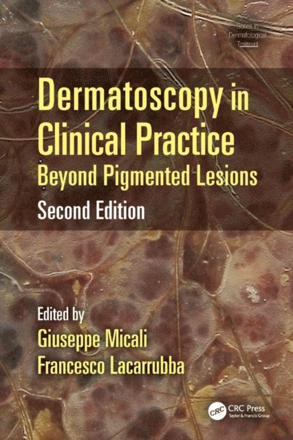 Francesco Lacarrubba, Giuseppe Micali - Dermatoscopy in Clinical Practice, E-bok