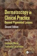 Dermatoscopy in Clinical Practice