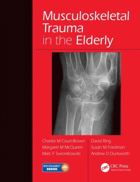 Andrew David Duckworth, Susan M. Friedman, David Ring, Marc F. Swiontkowski, Margaret McQueen, Charles Court-Brown - Musculoskeletal Trauma in the Elderly, E-bok