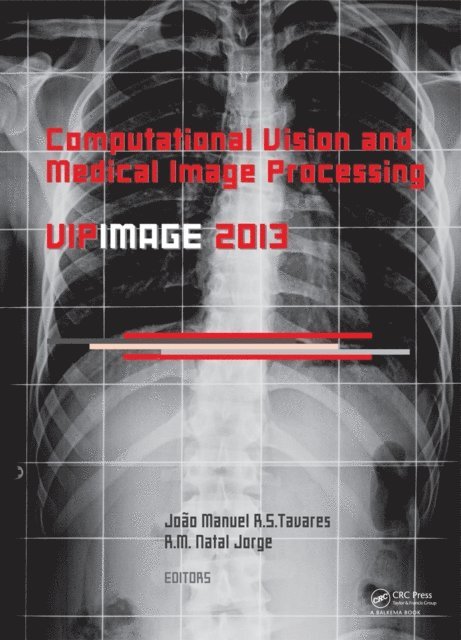 Jorge R.M. Natal, Joao Manuel RS Tavares - Computational Vision and Medical Image Processing IV, E-bok