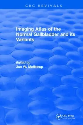 J.W. Meilstrup - Imaging Atlas of the Normal Gallbladder and Its Variants, Inbunden. Tillgänglighet: Lägg i varukorg