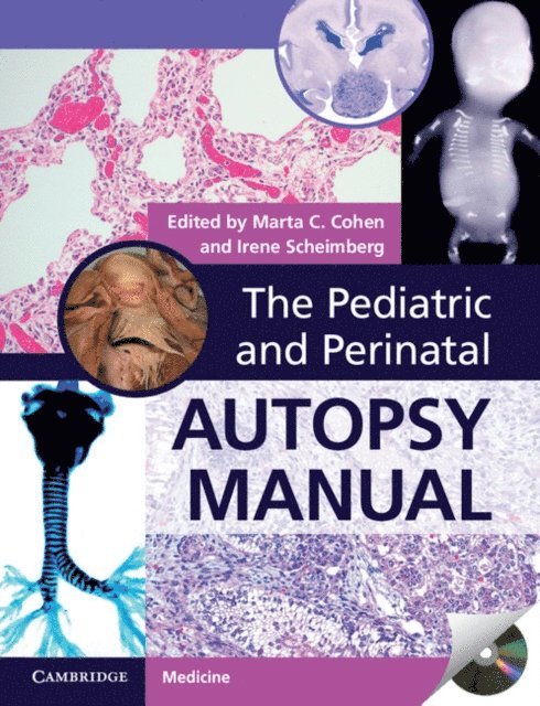 Irene Scheimberg, Marta C. Cohen - Pediatric and Perinatal Autopsy Manual, E-bok
