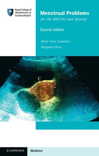 Margaret Rees, Mary Ann Lumsden - Menstrual Problems for the MRCOG and Beyond, E-bok