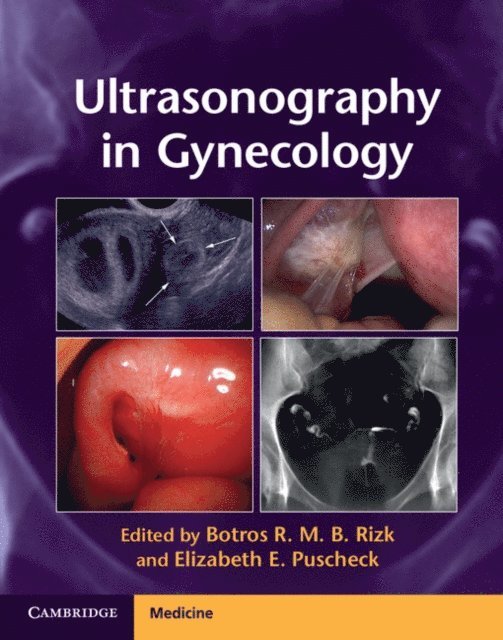 Elizabeth E. Puscheck, Botros R. M. B. Rizk - Ultrasonography in Gynecology, E-bok