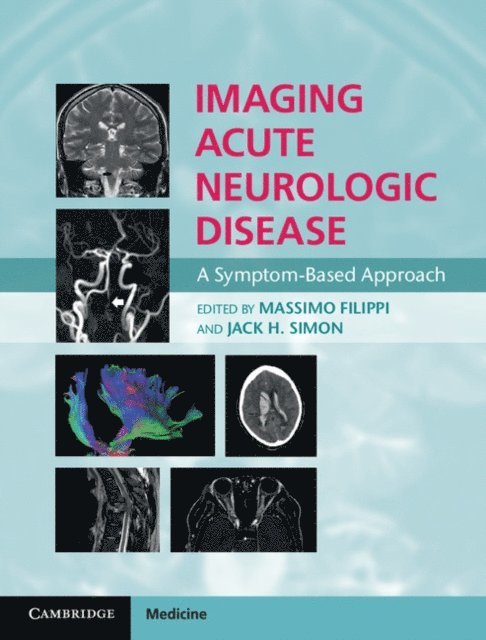 Jack H. Simon, Massimo Filippi - Imaging Acute Neurologic Disease, E-bok