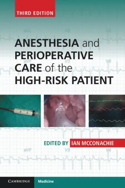 Ian McConachie - Anesthesia and Perioperative Care of the High-Risk Patient, E-bok. Tillgänglighet: Lägg i varukorg