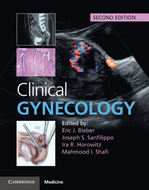 Mahmood I. Shafi, Ira R. Horowitz, Joseph S. Sanfilippo, Eric J. Bieber - Clinical Gynecology, E-bok