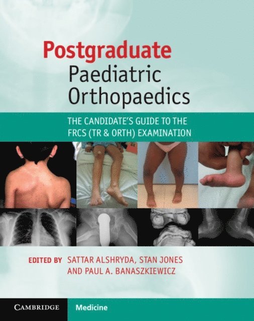 Paul A. Banaszkiewicz, Stan Jones, Sattar Alshryda - Postgraduate Paediatric Orthopaedics, E-bok