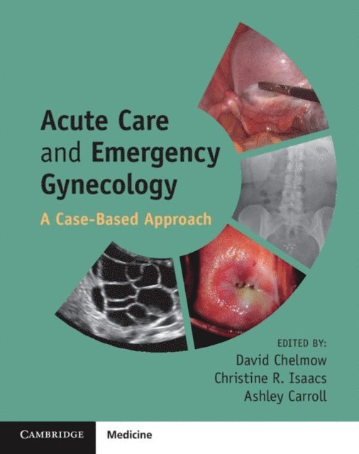 Ashley Carroll, Christine R. Isaacs, David Chelmow - Acute Care and Emergency Gynecology, E-bok