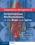 Comprehensive Management of Arteriovenous Malformations of the Brain and Spine