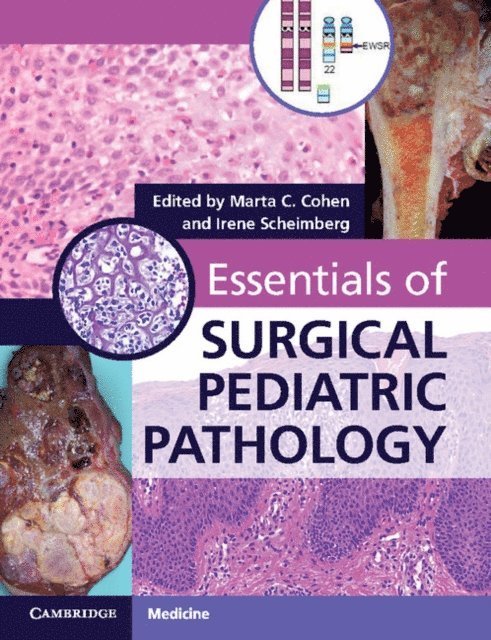 Irene Scheimberg, Marta C. Cohen - Essentials of Surgical Pediatric Pathology, E-bok