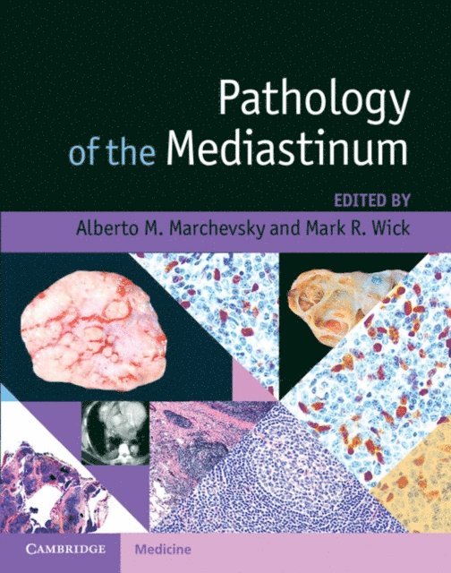 Mark R. Wick, Alberto M. Marchevsky - Pathology of the Mediastinum, E-bok