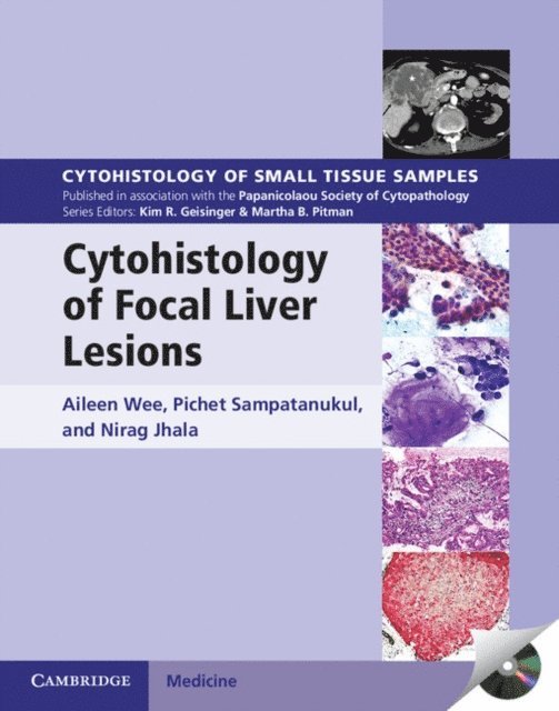 Nirag Jhala, Pichet Sampatanukul, Aileen Wee - Cytohistology of Focal Liver Lesions, E-bok