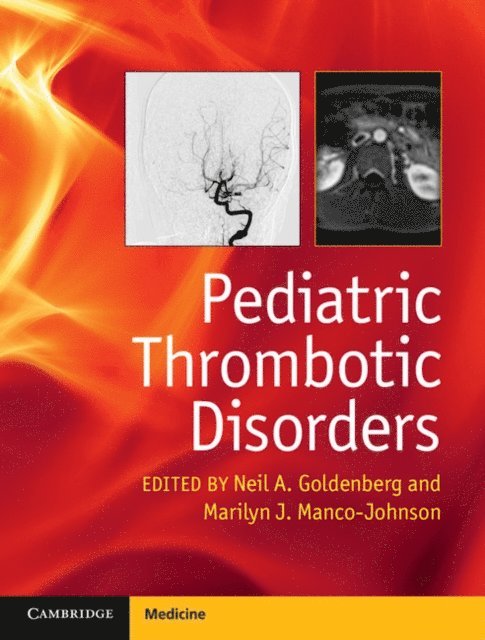 Pediatric Thrombotic Disorders