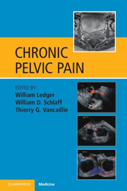 Thierry G. Vancaillie, William D. Schlaff, William Ledger - Chronic Pelvic Pain, E-bok