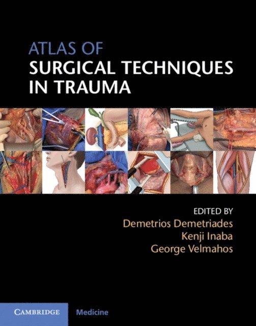 George Velmahos, Kenji Inaba, Demetrios Demetriades - Atlas of Surgical Techniques in Trauma, E-bok
