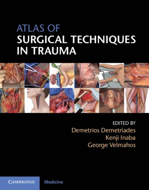 George Velmahos, Kenji Inaba, Demetrios Demetriades - Atlas of Surgical Techniques in Trauma, E-bok