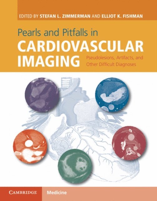 Elliot K. Fishman, Stefan L. Zimmerman - Pearls and Pitfalls in Cardiovascular Imaging, E-bok