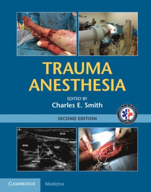 Charles E. Smith - Trauma Anesthesia, E-bok