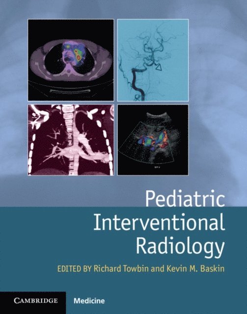 Kevin Baskin, Richard Towbin - Pediatric Interventional Radiology, E-bok