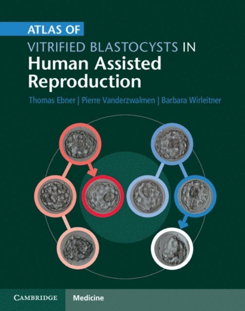 Barbara Wirleitner, Pierre Vanderzwalmen, Thomas Ebner - Atlas of Vitrified Blastocysts in Human Assisted Reproduction, E-bok