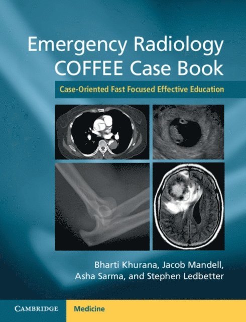 Stephen Ledbetter, Asha Sarma, Jacob Mandell, Bharti Khurana - Emergency Radiology COFFEE Case Book, E-bok