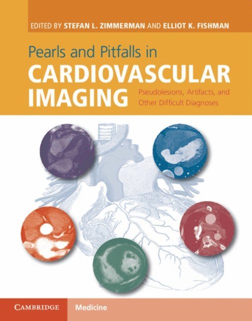 Elliot K. Fishman, Stefan L. Zimmerman - Pearls and Pitfalls in Cardiovascular Imaging, E-bok