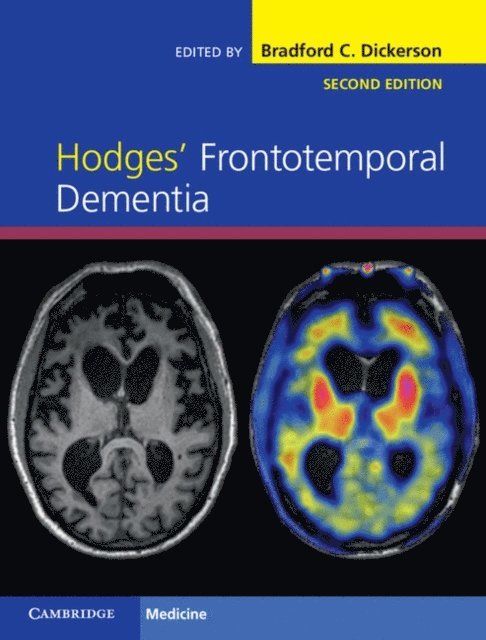 Bradford C. Dickerson - Hodges' Frontotemporal Dementia, E-bok