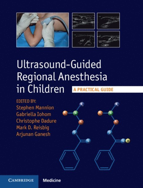 Arjunan Ganesh, Mark D. Reisbig, Christophe Dadure, Gabrielle Iohom, Stephen Mannion - Ultrasound-Guided Regional Anesthesia in Children, E-bok. Tillgänglighet: Lägg i varukorg