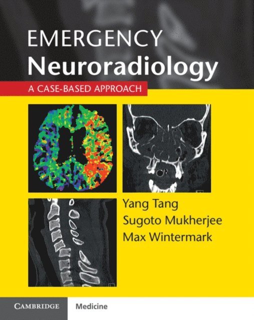 Max Wintermark, Sugoto Mukherjee, Yang Tang - Emergency Neuroradiology, E-bok
