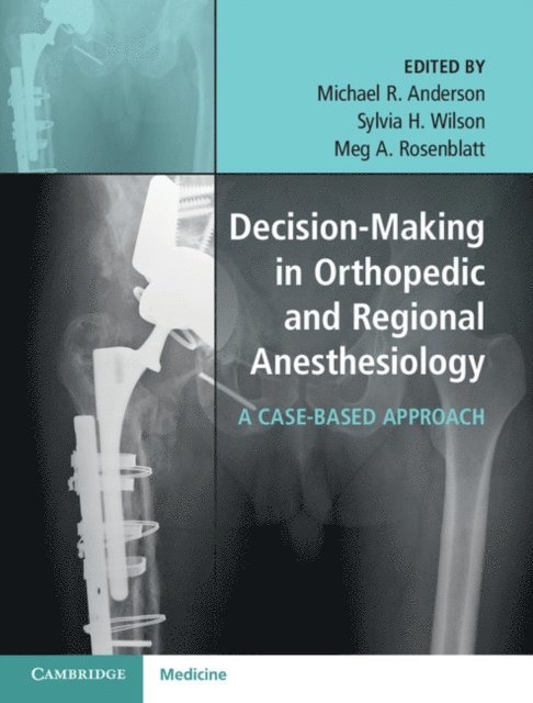 Meg A. Rosenblatt, Sylvia H. Wilson, Michael R. Anderson - Decision-Making in Orthopedic and Regional Anesthesiology, E-bok
