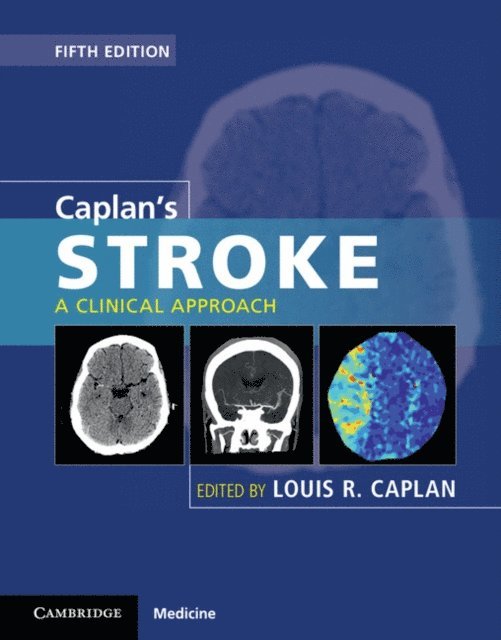 Louis R. Caplan - Caplan's Stroke, E-bok