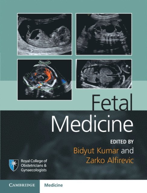 Zarko Alfirevic, Bidyut Kumar - Fetal Medicine, E-bok
