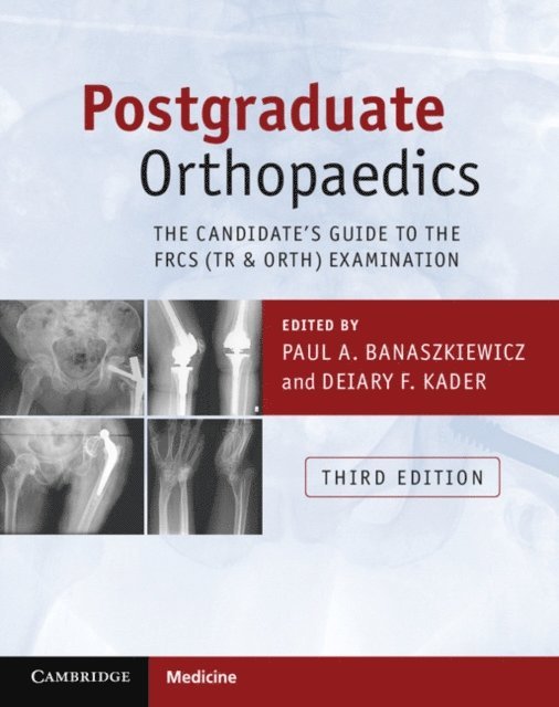 Deiary F. Kader, Paul A. Banaszkiewicz - Postgraduate Orthopaedics, E-bok
