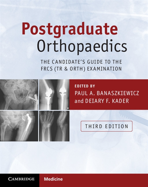 Deiary F. Kader, Paul A. Banaszkiewicz - Postgraduate Orthopaedics, E-bok