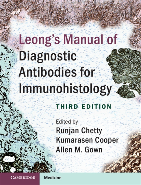 Allen M. Gown, Kumarasen Cooper, Runjan Chetty - Leong's Manual of Diagnostic Antibodies for Immunohistology, E-bok
