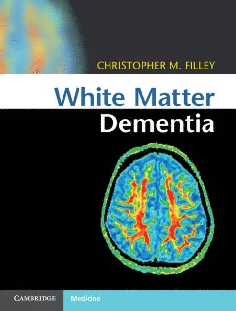 Christopher M. Filley - White Matter Dementia, E-bok. Tillgänglighet: Lägg i varukorg