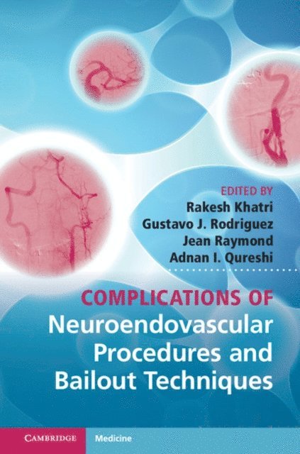 Adnan I. Qureshi, Jean Raymond, Gustavo J. Rodriguez, Rakesh Khatri - Complications of Neuroendovascular Procedures and Bailout Techniques, E-bok