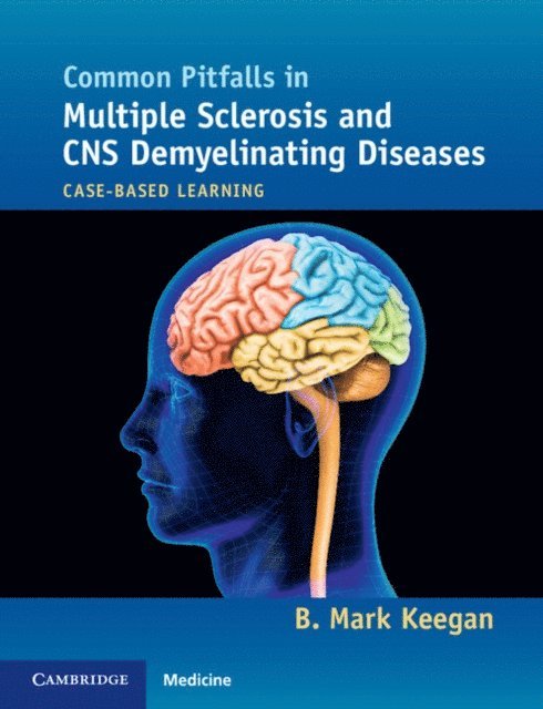 B. Mark Keegan - Common Pitfalls in Multiple Sclerosis and CNS Demyelinating Diseases, E-bok