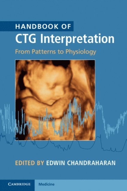 Edwin Chandraharan - Handbook of CTG Interpretation, E-bok