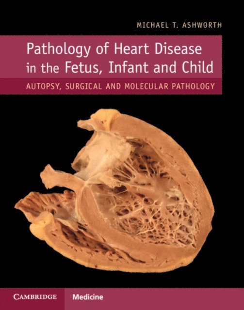 Michael T. Ashworth - Pathology of Heart Disease in the Fetus, Infant and Child, E-bok